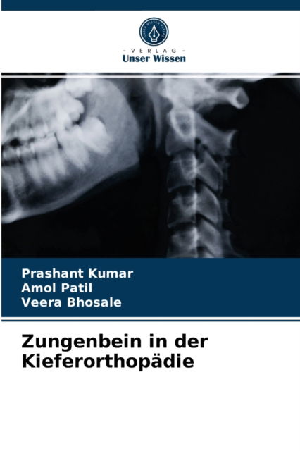 Cover for Prashant Kumar · Zungenbein in der Kieferorthopadie (Taschenbuch) (2021)