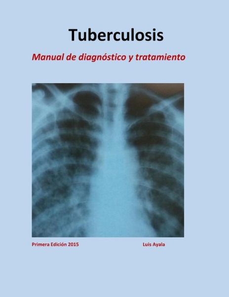 Cover for Yessy Carolina Arriaga · Tratamiento de Tuberculosis (Paperback Book) (2015)