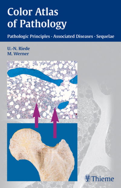 Cover for Urs-Nikolaus Riede · Color Atlas of Pathology: Pathologic Principles, Associated Diseases, Sequela (Paperback Book) (2004)