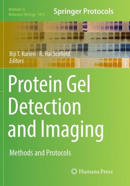 Cover for Protein Gel Detection and Imaging (Book) [Softcover reprint of the original 1st ed. 2018 edition] (2019)