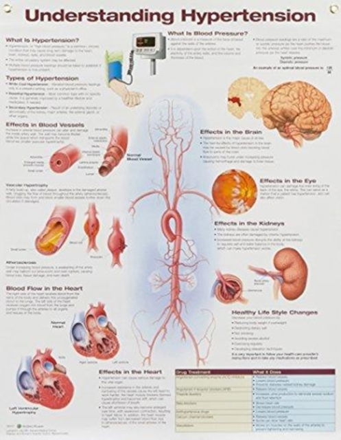 Understanding Hypertension Anatomical Chart - Anatomical Chart Com - Kirjat - Lippincott Williams and Wilkins - 9781496369819 - torstai 21. syyskuuta 2017