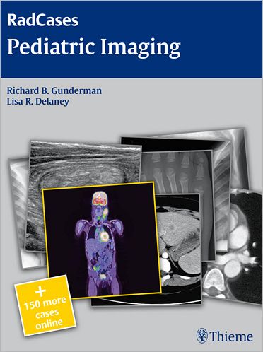 Cover for Richard B. Gunderman · Radcases Pediatric Imaging - Radcases Plus Q&amp;A (Paperback Book) (2010)