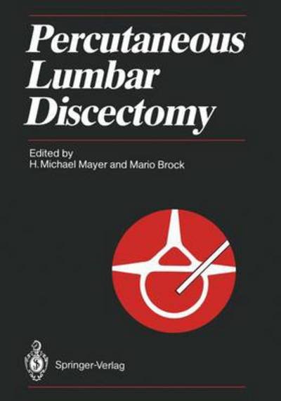 Cover for H Michael Mayer · Percutaneous Lumbar Discectomy (Paperback Bog) [Softcover reprint of the original 1st ed. 1989 edition] (2011)