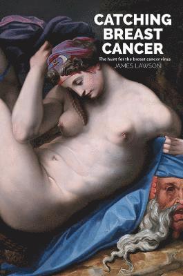 Cover for James Lawson · Catching Breast Cancer: The hunt for the breast cancer virus (Paperback Book) (2022)