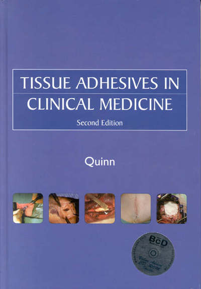 Tissue Adhesives in Clinical Medicine - James Quinn - Książki - B.C. Decker Inc - 9781550092820 - 16 lutego 2005