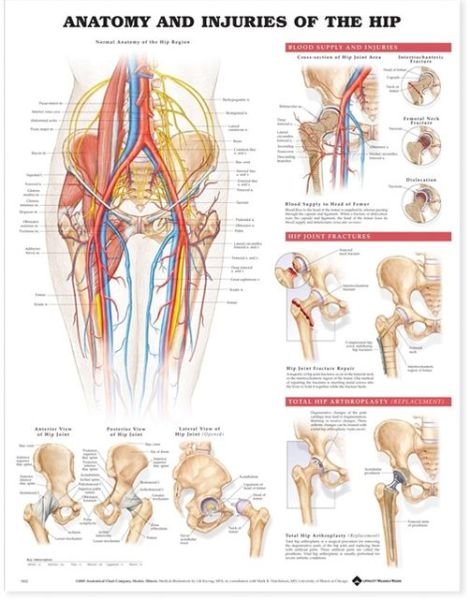 Cover for Acc 9802pu · Anatomy and Injuries of the Hip Anatomical Chart (Map) (2002)