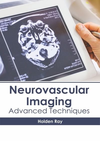 Cover for Holden Ray · Neurovascular Imaging: Advanced Techniques (Innbunden bok) (2019)