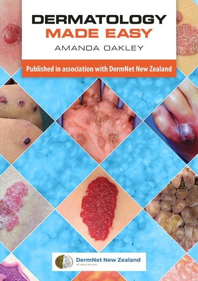 Cover for Oakley, Amanda (Adjunct Associate Professor, Department of Medicine, University of Auckland, New Zealand) · Dermatology Made Easy (Paperback Bog) (2017)