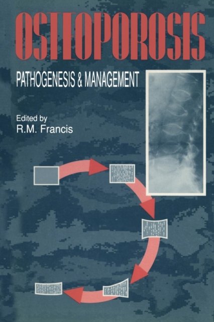 Cover for R M Francis · Osteoporosis: Pathogenesis and Management (Pocketbok) [Softcover reprint of the original 1st ed. 1990 edition] (2013)
