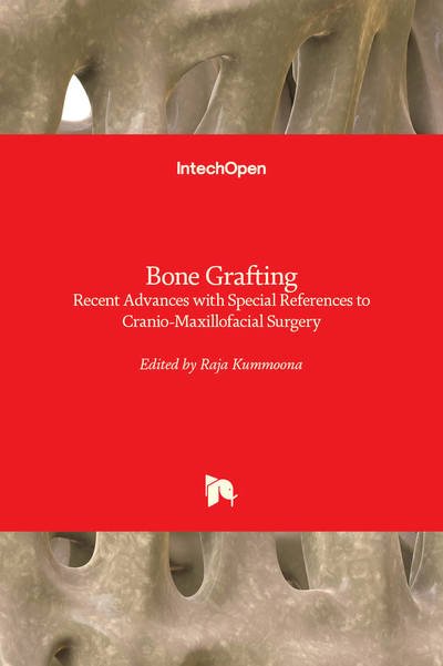 Cover for Raja Kummoona · Bone Grafting (Hardcover Book) (2018)