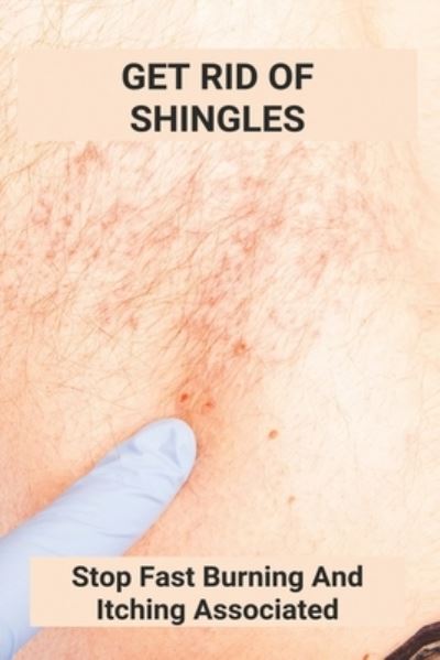 Cover for Mana Voetmann · Get Rid Of Shingles (Paperback Book) (2021)