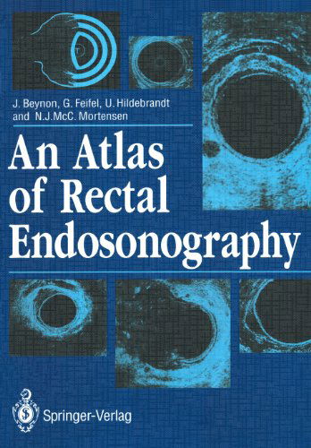 Cover for John Beynon · An Atlas of Rectal Endosonography (Taschenbuch) [Softcover reprint of the original 1st ed. 1991 edition] (2011)