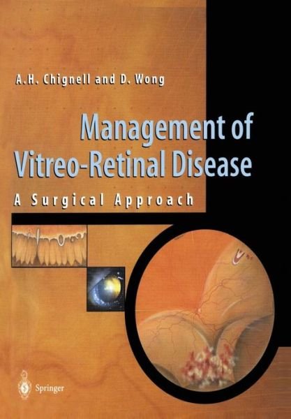 Cover for David Wong · Management of Vitreo-retinal Disease: a Surgical Approach (Taschenbuch) (1998)