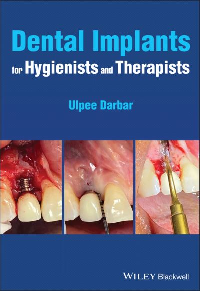 Cover for Darbar, Ulpee R. (Eastman Dental Hospital, London, UK) · Dental Implants for Hygienists and Therapists (Paperback Book) (2022)