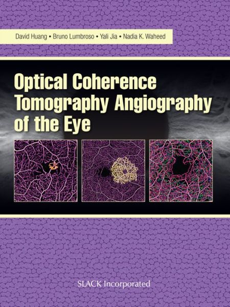 Optical Coherence Tomography Angiography of the Eye: OCT Angiography - David Huang - Bücher - SLACK  Incorporated - 9781630912826 - 17. Juli 2017