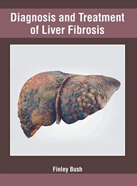 Cover for Finley Bush · Diagnosis and Treatment of Liver Fibrosis (Hardcover Book) (2019)