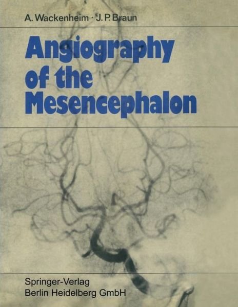 Cover for Auguste Wackenheim · Angiography of the Mesencephalon: Normal and Pathological Findings (Paperback Book) [Softcover Reprint of the Original 1st 1970 edition] (1970)