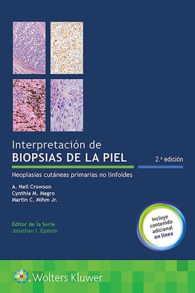 Interpretacion de biopsias de la piel: Neoplasias cutaneas primarias no linfoides - A. Neil Crowson - Bøker - Lippincott Williams & Wilkins - 9788417602826 - 24. januar 2020