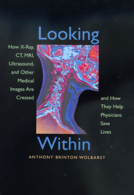 Cover for Anthony Brinton Wolbarst · Looking Within: How X-Ray, CT, MRI, Ultrasound, and Other Medical Images Are Created, and How They Help Physicians Save Lives (Paperback Book) (1999)
