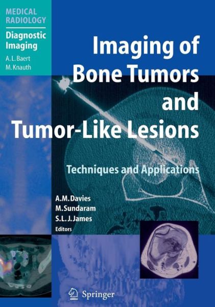 Cover for A M Davies · Imaging of Bone Tumors and Tumor-Like Lesions: Techniques and Applications - Medical Radiology (Hardcover Book) [2009 edition] (2009)