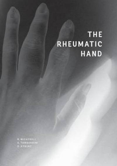 Cover for Raphael Micheroli · The Rheumatic Hand (Paperback Book) (2015)