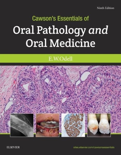 Cover for Odell, Edward W, FDSRCS, MSc, PhD, FRCPath (Professor of Oral Pathology and Medicine, King's College London; Honorary Consultant in Oral Pathology, Guy's and St Thomas' NHS Foundation Trust, London) · Cawson's Essentials of Oral Pathology and Oral Medicine (Paperback Book) (2017)
