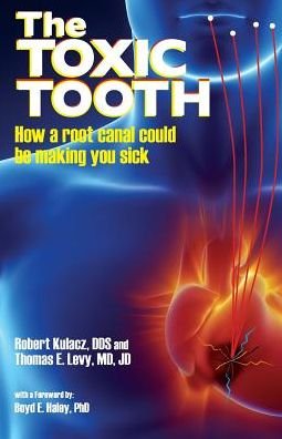Cover for Dds Robert Kulacz · The Toxic Tooth: How a Root Canal Could Be Making You Sick (Pocketbok) (2014)