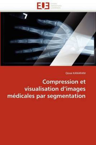 Cover for Qosai Kanafani · Compression et Visualisation D'images Médicales Par Segmentation (Pocketbok) [French edition] (2018)