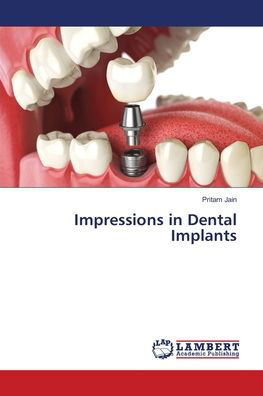 Cover for Jain · Impressions in Dental Implants (Bog) (2018)