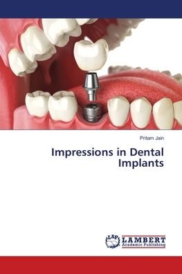 Cover for Jain · Impressions in Dental Implants (Bok) (2018)