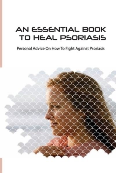Cover for Zada Garrell · An Essential Book To Heal Psoriasis- Personal Advice On How To Fight Against Psoriasis (Paperback Book) (2020)
