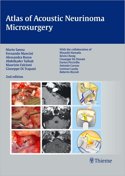 Cover for Mario Sanna · Atlas of Acoustic Neurinoma Microsurgery (Inbunden Bok) (2010)