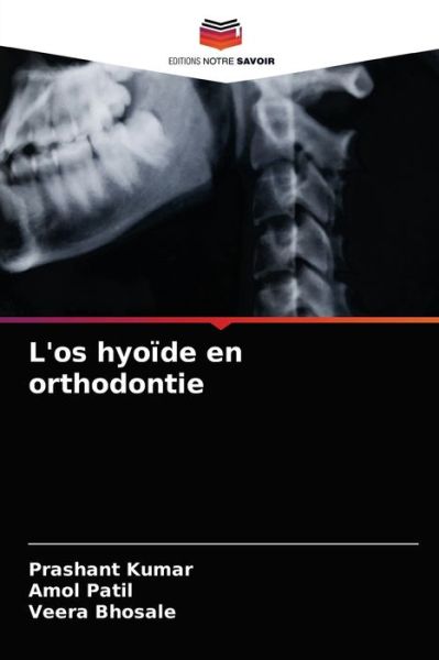 Cover for Prashant Kumar · L'os hyoide en orthodontie (Pocketbok) (2021)