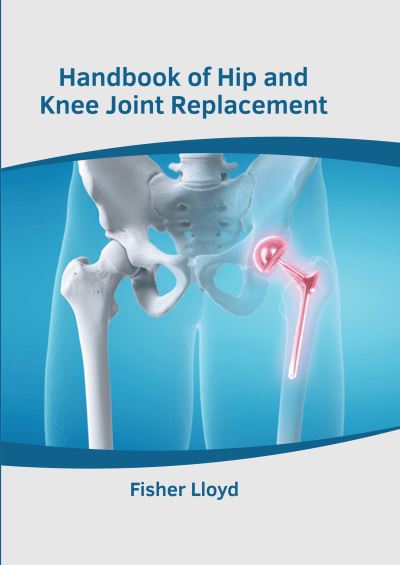 Handbook of Hip and Knee Joint Replacement - Fisher Lloyd - Books - Murphy & Moore Publishing - 9781639872831 - September 20, 2022