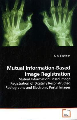 Cover for K. A. Bachman · Mutual Information-based Image Registration: Mutual Information-based Image Registration of Digitally Reconstructed Radiographs and Electronic Portal Images (Paperback Book) (2009)