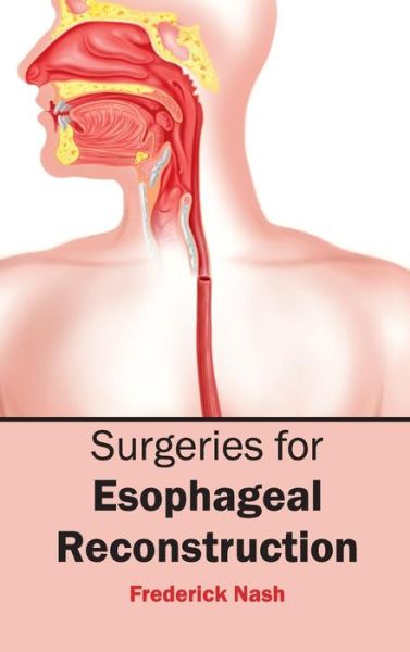 Cover for Frederick Nash · Surgeries for Esophageal Reconstruction (Hardcover Book) (2015)