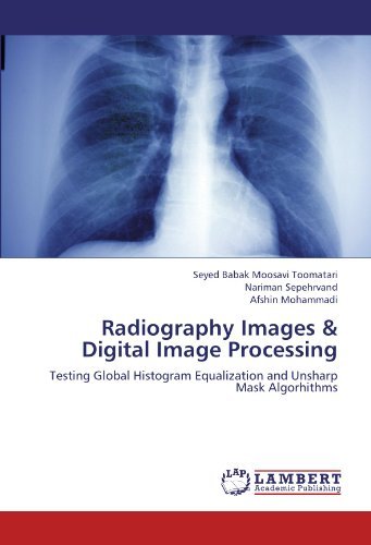 Cover for Afshin Mohammadi · Radiography Images &amp; Digital Image Processing: Testing Global Histogram Equalization and Unsharp Mask Algorhithms (Pocketbok) (2012)