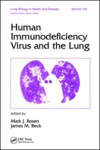 Human Immunodeficiency Virus and the Lung - Lung Biology in Health and Disease - Mark J. Rosen - Bøger - Taylor & Francis Inc - 9780824798833 - 26. juni 1998