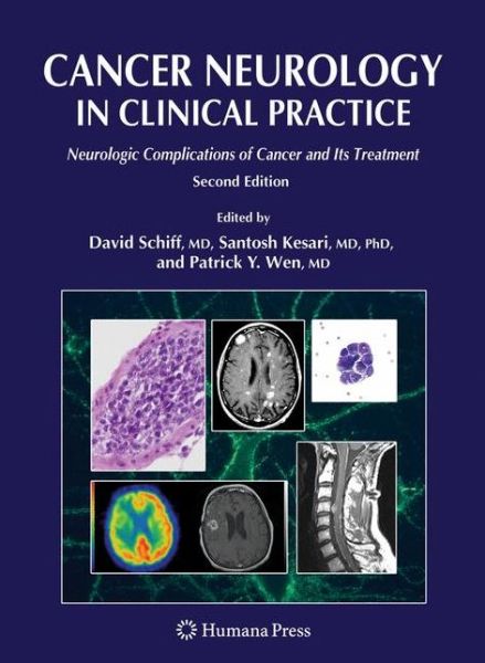 Cover for Cancer Neurology in Clinical Practice: Neurologic Complications of Cancer and Its Treatment (Hardcover Book) [Second Edition 2008 edition] (2008)