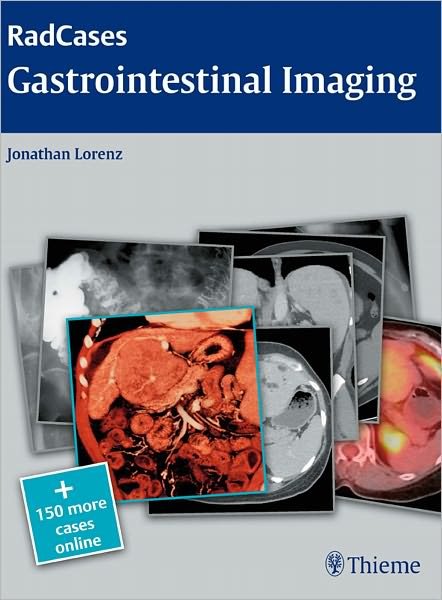 Radcases Gastrointestinal Imaging - Radcases Plus Q&A - Jonathan M. Lorenz - Kirjat - Thieme Medical Publishers Inc - 9781604061833 - torstai 2. joulukuuta 2010