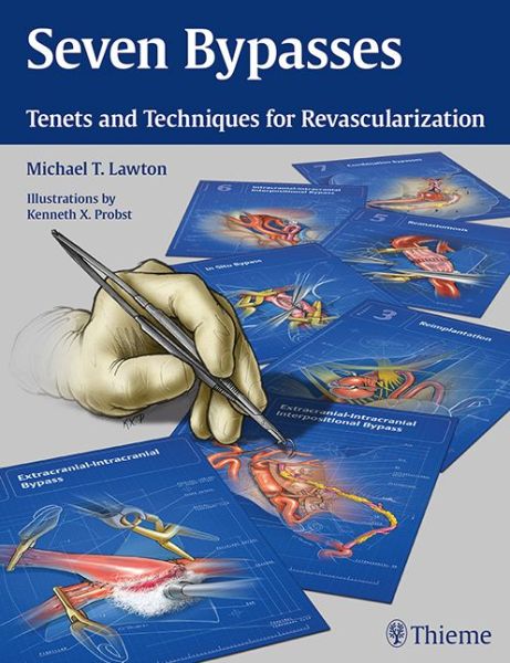 Cover for Michael T. Lawton · Seven Bypasses: Tenets and Techniques for Revascularization (Hardcover Book) [New edition] (2018)