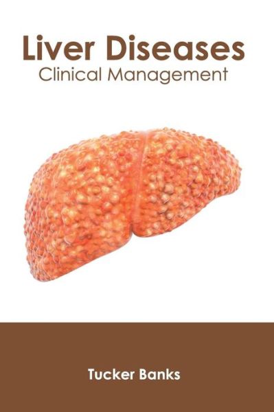 Liver Diseases: Clinical Management - Tucker Banks - Bøger - Foster Academics - 9781632426833 - 11. juni 2019