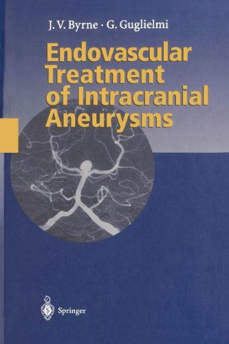 Cover for James Byrne · Endovascular Treatment of Intracranial Aneurysms (Paperback Book) [Softcover reprint of the original 1st ed. 1998 edition] (2011)