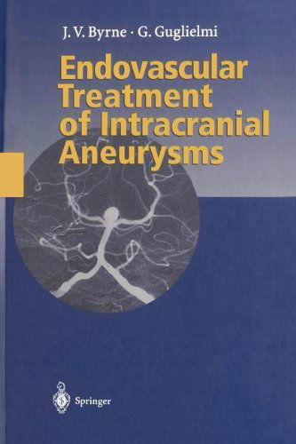 Cover for James Byrne · Endovascular Treatment of Intracranial Aneurysms (Taschenbuch) [Softcover reprint of the original 1st ed. 1998 edition] (2011)