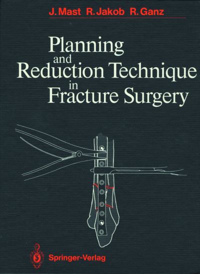 Cover for Jeffrey Mast · Planning and Reduction Technique in Fracture Surgery (Hardcover Book) [1989 edition] (1988)