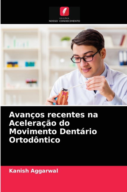 Cover for Kanish Aggarwal · Avancos recentes na Aceleracao do Movimento Dentario Ortodontico (Paperback Book) (2021)