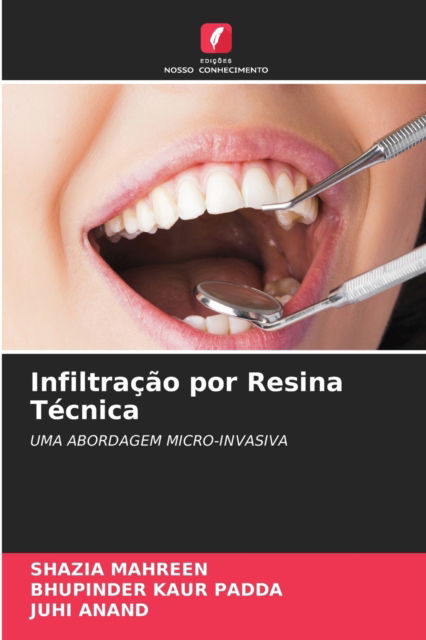 Cover for Shazia Mahreen · Infiltracao por Resina Tecnica (Paperback Book) (2021)