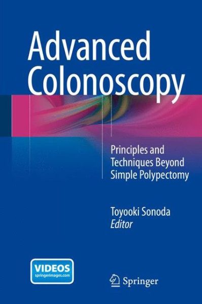 Cover for Toyooki Sonoda · Advanced Colonoscopy: Principles and Techniques Beyond Simple Polypectomy (Hardcover Book) [2014 edition] (2014)