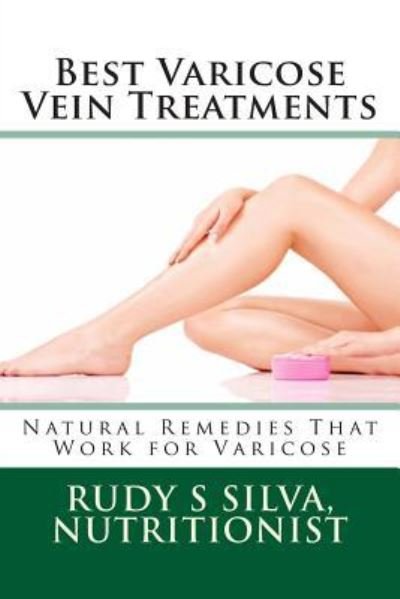 Cover for Rudy Silva Silva · Best Varicose Vein Treatments: Natural Remedies That Work for Varicose (Paperback Bog) (2013)