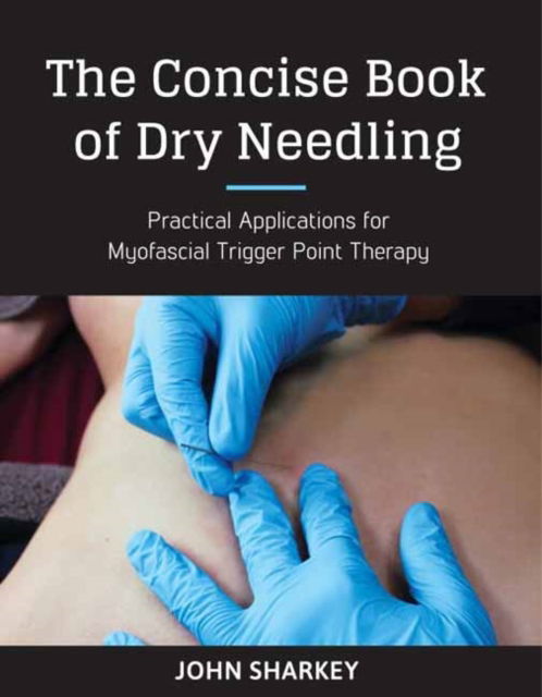 The Concise Book of Dry Needling: A Practitioner's Guide to Myofascial Trigger Point Applications - John Sharkey - Books - North Atlantic Books,U.S. - 9781623170837 - January 24, 2017